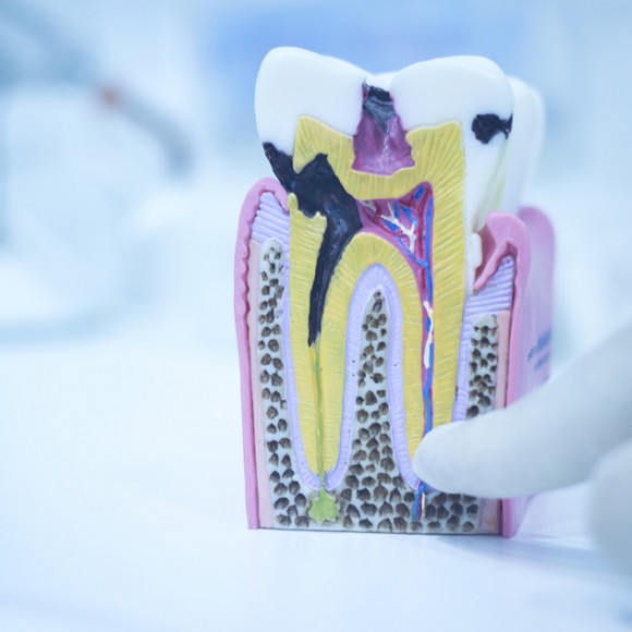 Denists Against Root Canals Denists Against Root Canals